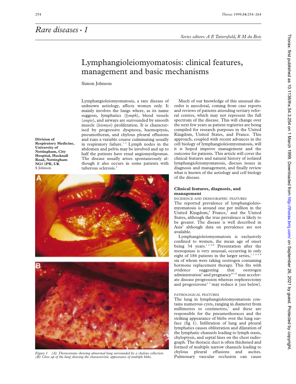 Rare Diseases C 1 Lymphangioleiomyomatosis: Clinical Features, Management and Basic Mechanisms