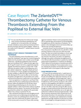 Extensive DVT of the Femoral and External Iliac Veins Case Study
