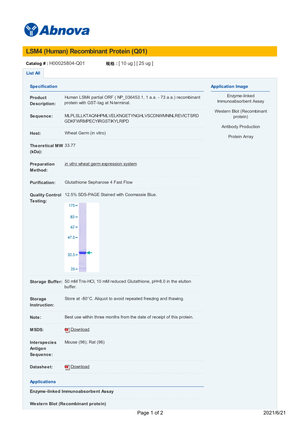 LSM4 (Human) Recombinant Protein (Q01)