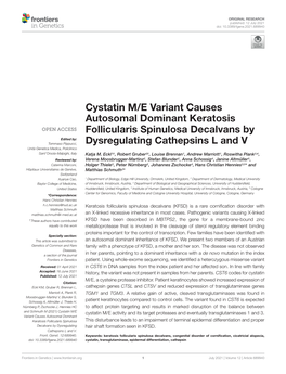 Cystatin M/E Variant Causes Autosomal Dominant
