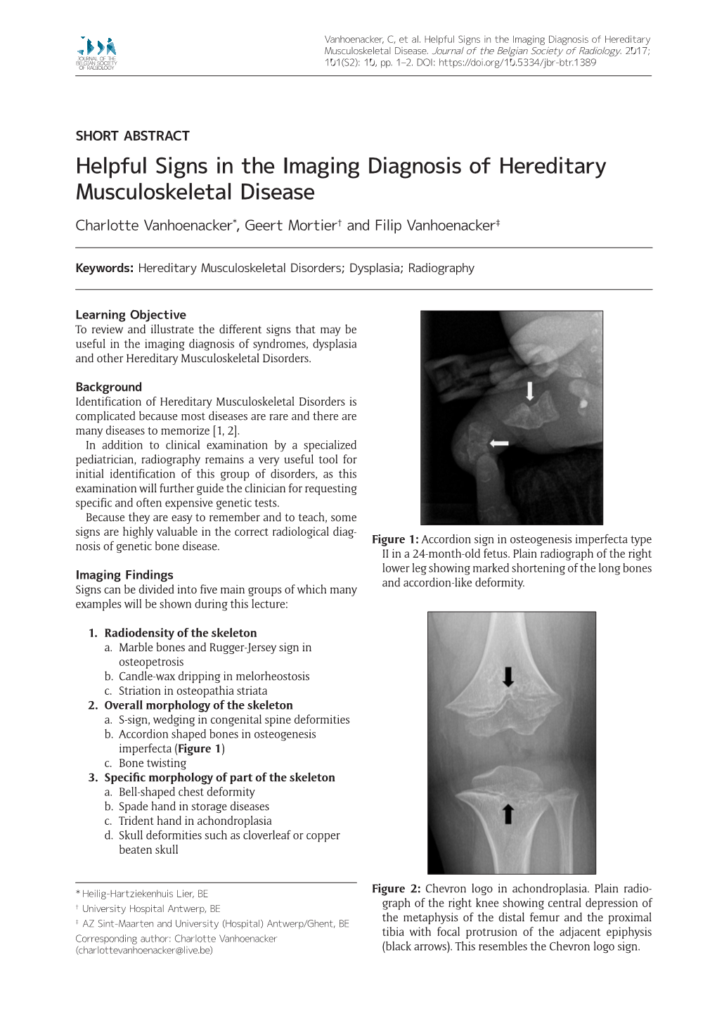 Helpful Signs in the Imaging Diagnosis of Hereditary Musculoskeletal Disease