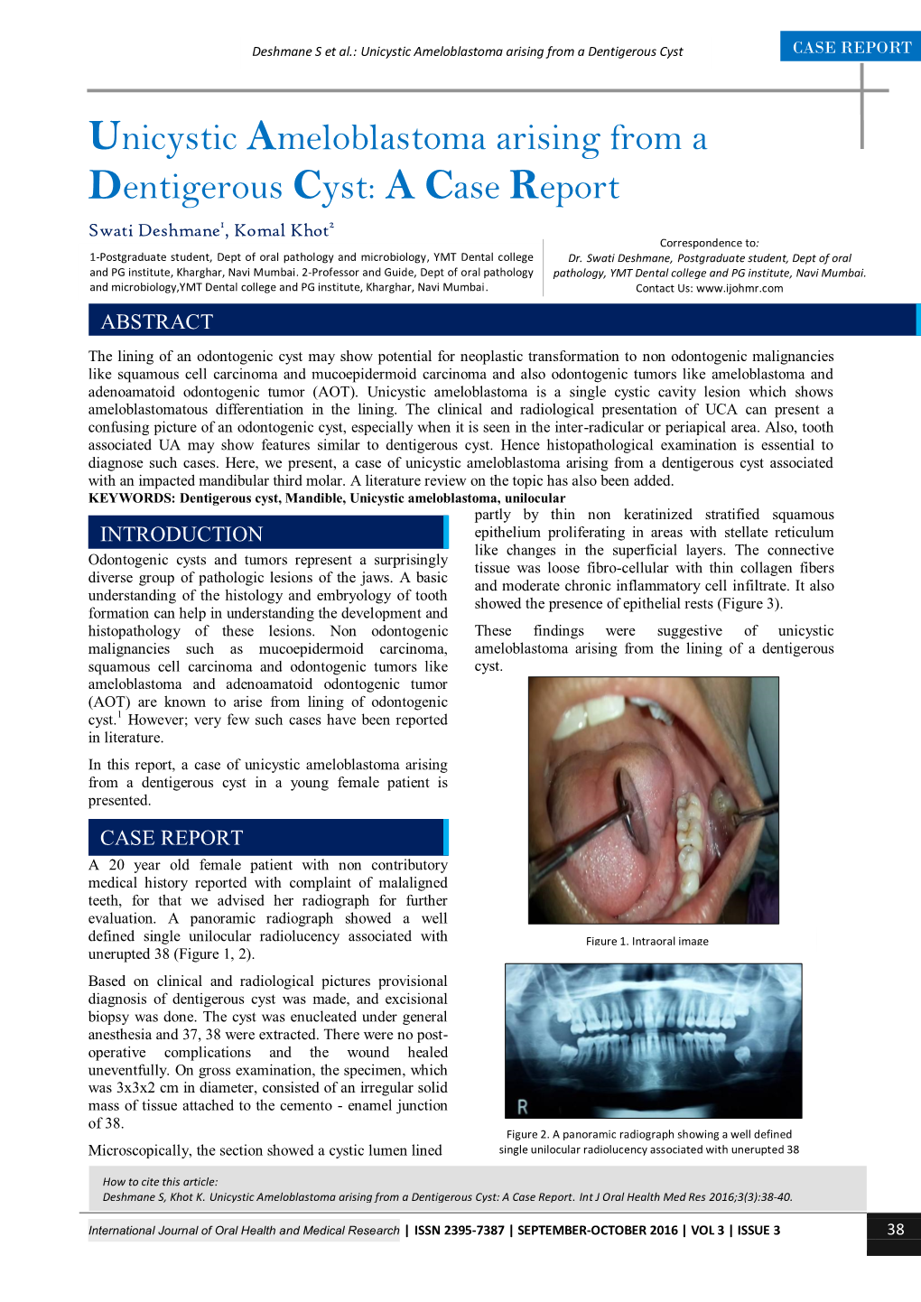 Unicystic Ameloblastoma Arising from a Dentigerous Cyst: a Case Report