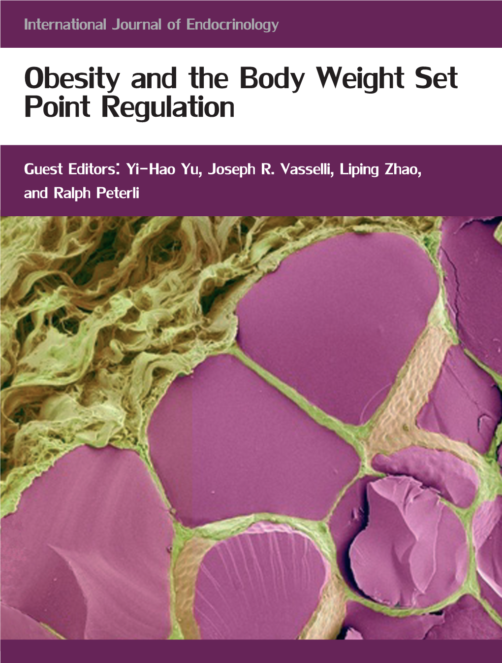 Obesity and the Body Weight Set Point Regulation