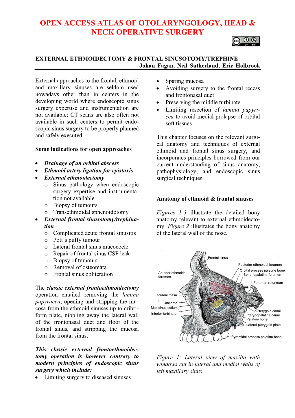 External Ethmoidectomy and Frontal Sinus Trephine