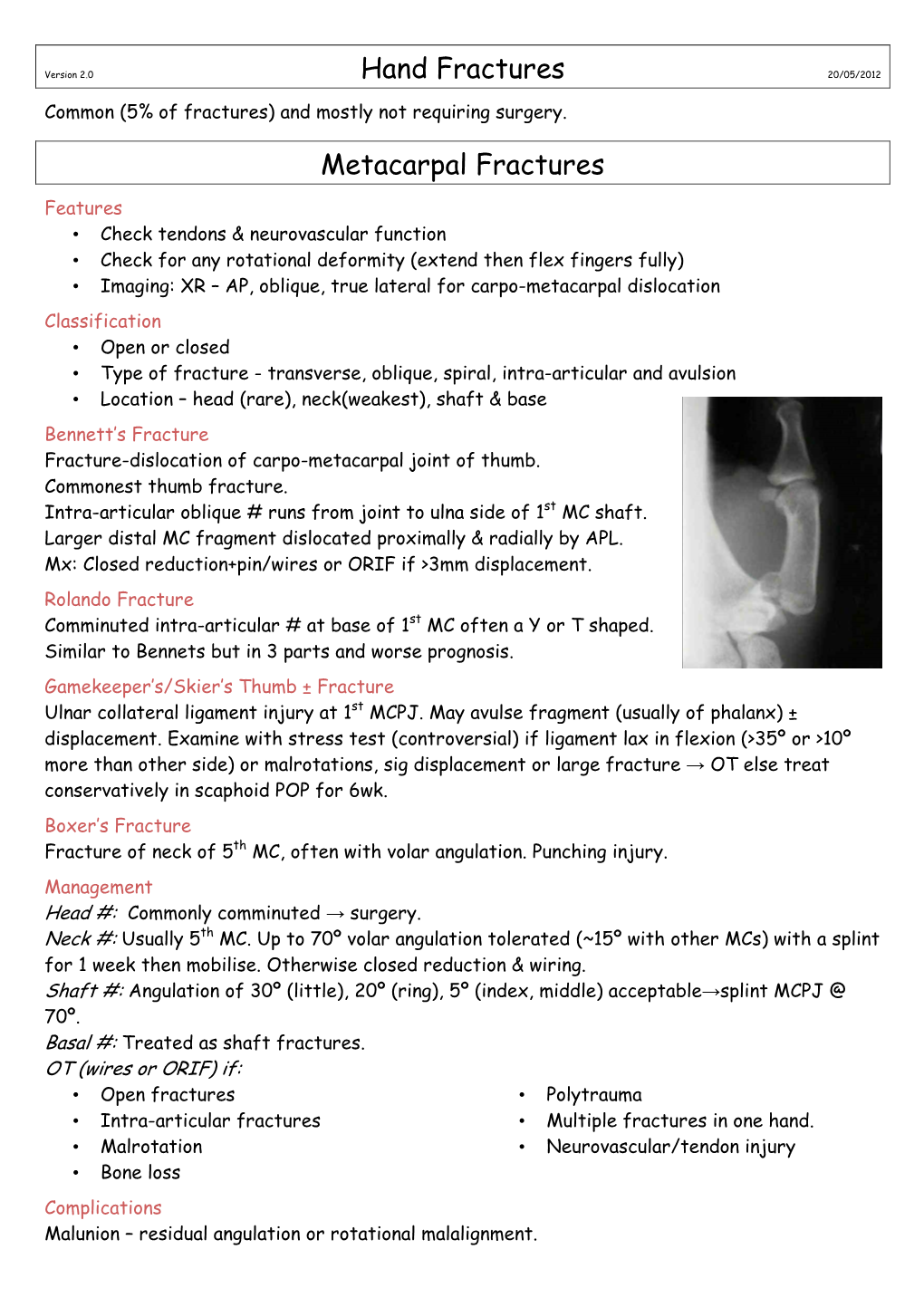 Hand Fractures Metacarpal Fractures