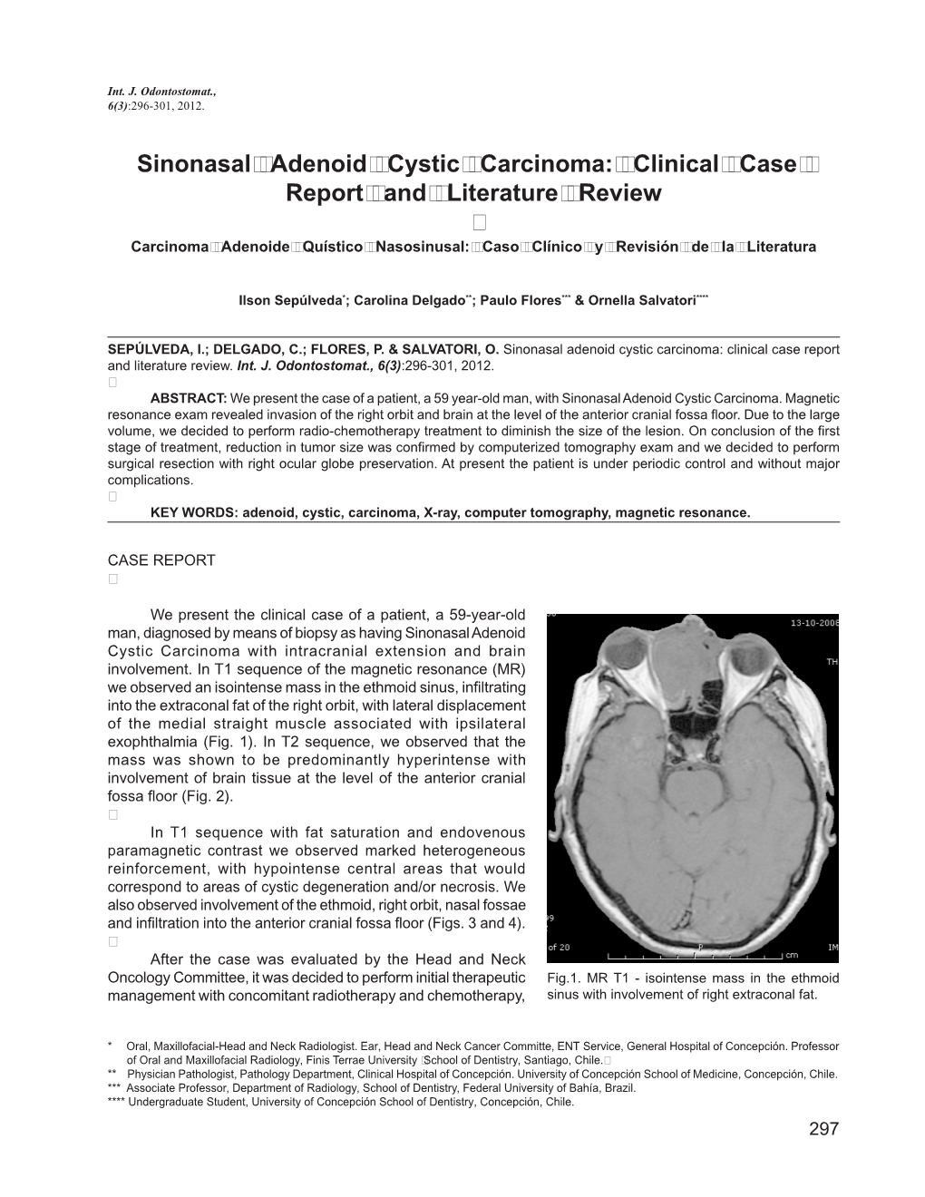 Sinonasal Adenoid Cystic Carcinoma: Clinical Case Report and Literature Review