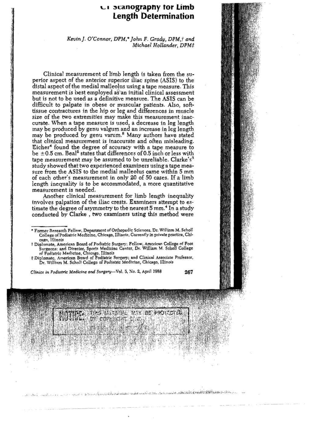 CT Scanography for Limb Length Determination