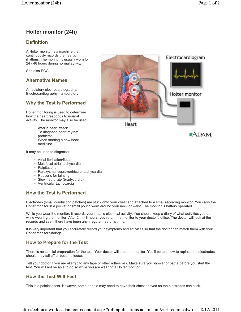Holter Monitor (24H) Page 1 of 2