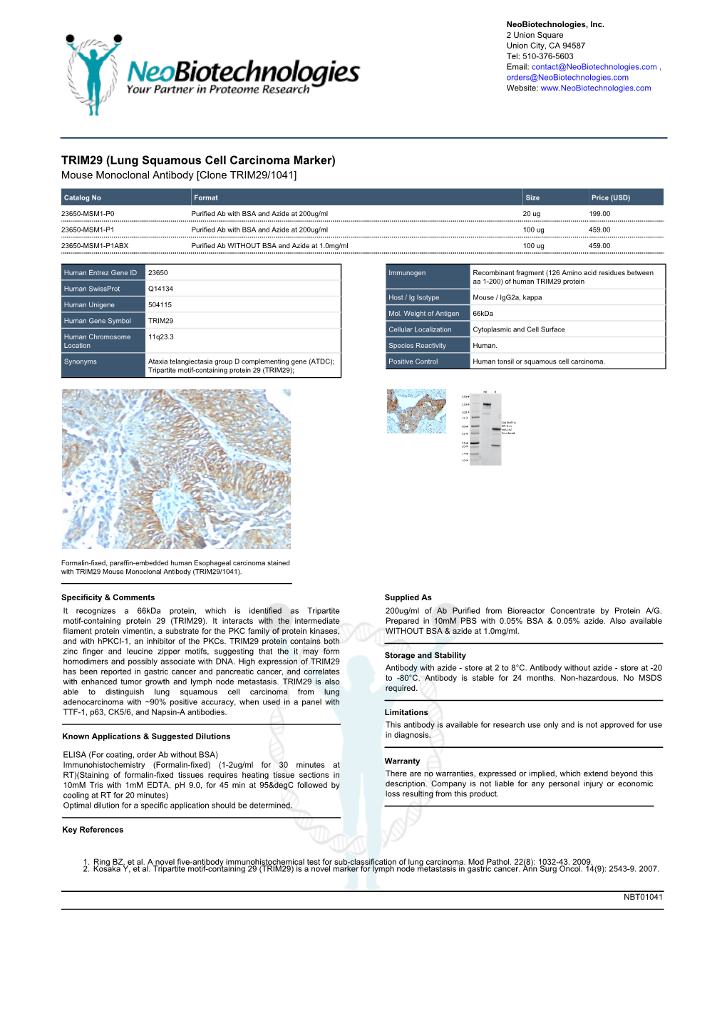 TRIM29 (Lung Squamous Cell Carcinoma Marker) Mouse Monoclonal Antibody [Clone TRIM29/1041]