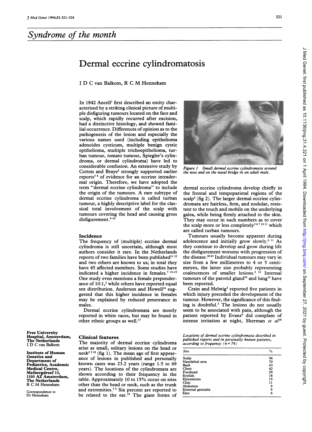 Syndrome of the Month Dermal Eccrine Cylindromatosis