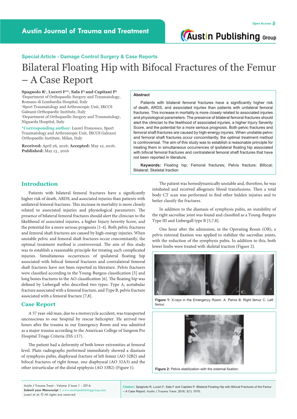 Bilateral Floating Hip with Bifocal Fractures of the Femur – a Case Report