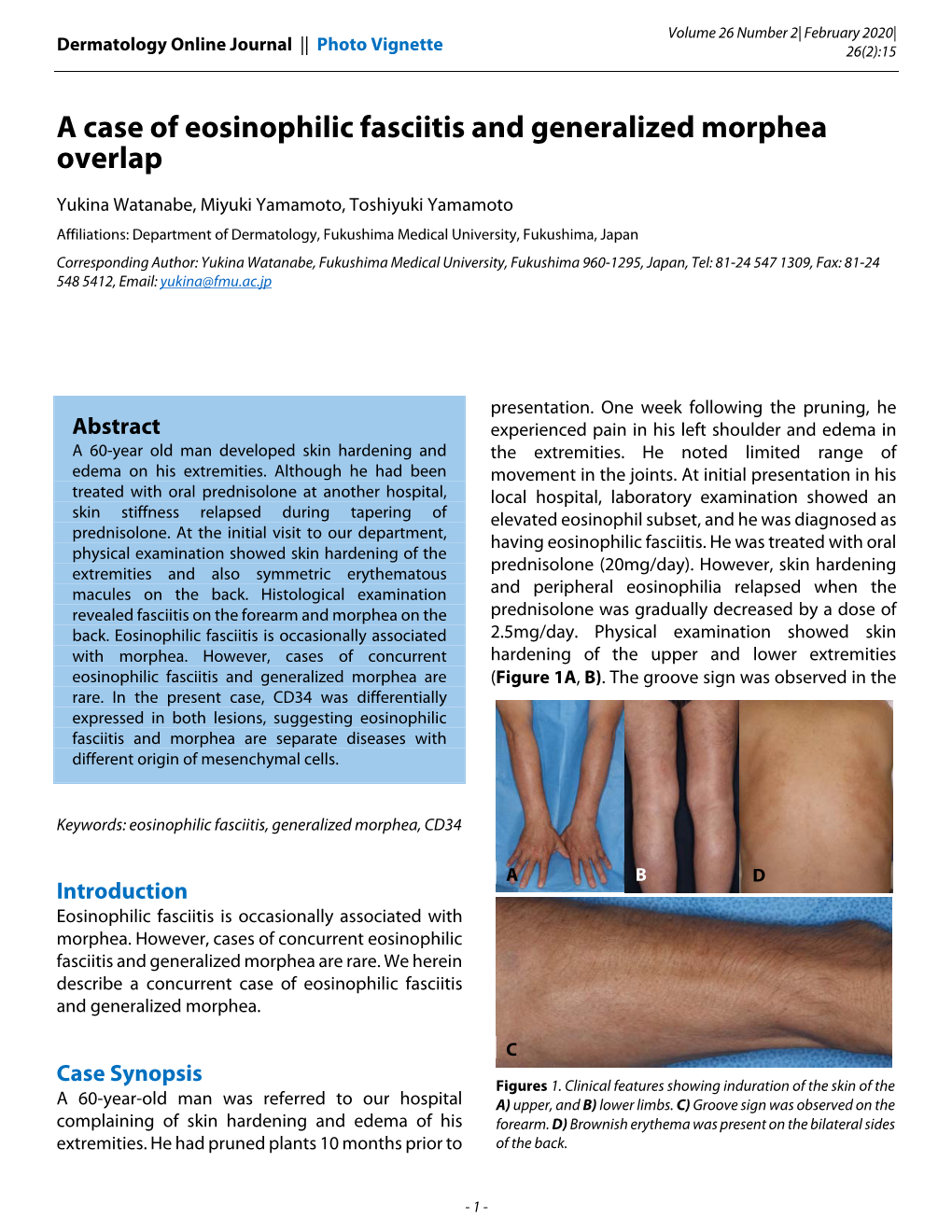 A Case of Eosinophilic Fasciitis and Generalized Morphea Overlap