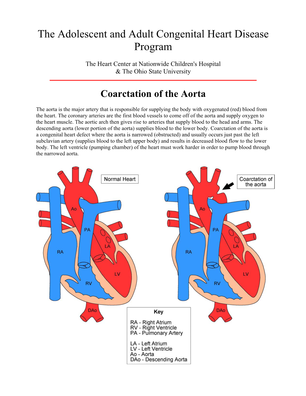 Coarctation of the Aorta