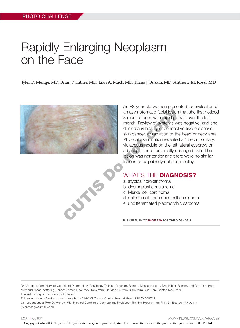 Rapidly Enlarging Neoplasm on the Face