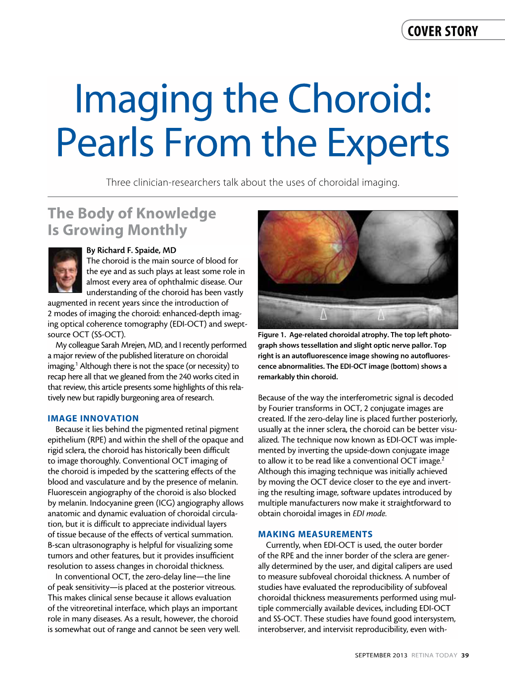 Imaging the Choroid: Pearls from the Experts