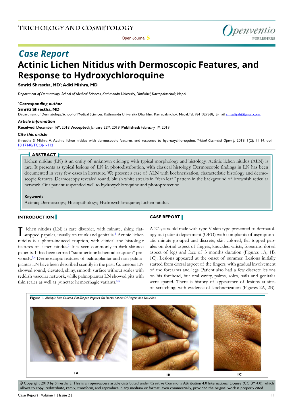 Actinic Lichen Nitidus with Dermoscopic Features, and Response to Hydroxychloroquine Case Report