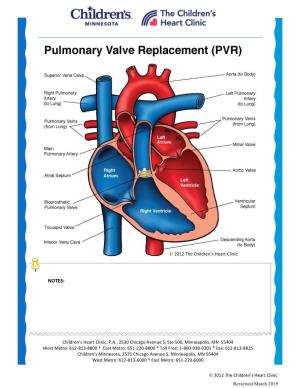 Pulmonary Valve Replacement (PVR)