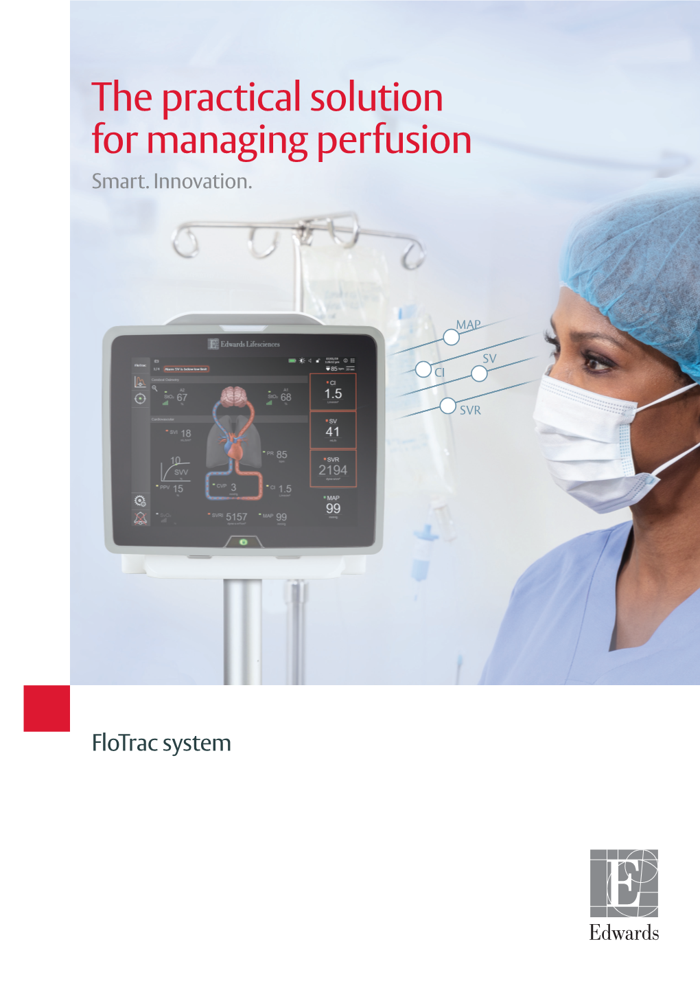 The Practical Solution for Managing Perfusion Smart