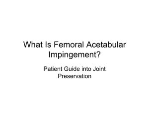 What Is Femoral Acetabular Impingement?