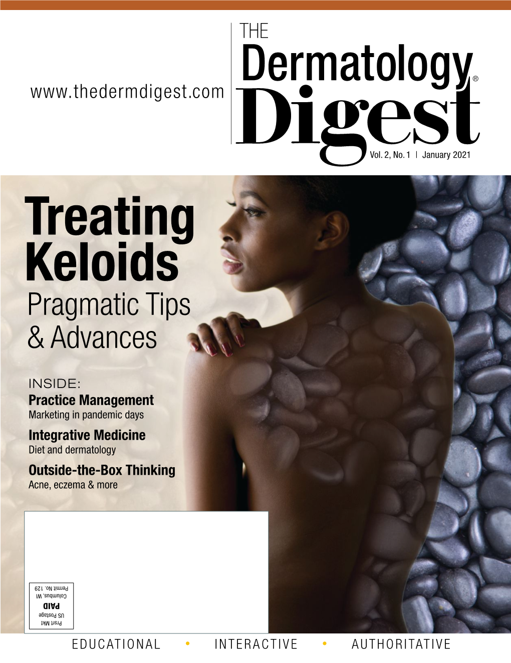 Treating Keloids Pragmatic Tips & Advances