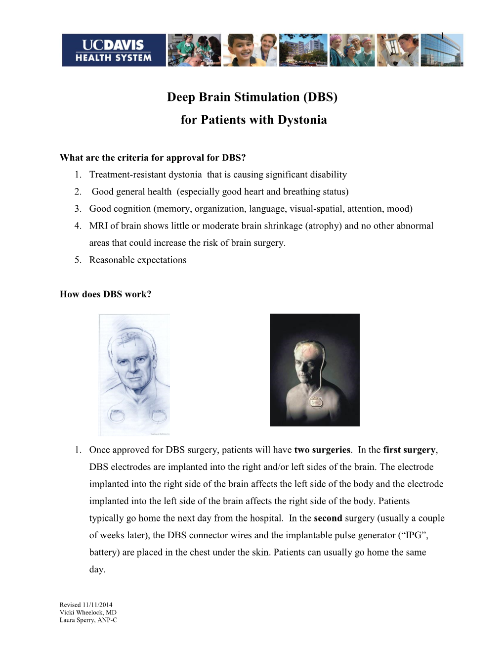 Deep Brain Stimulation (DBS) for Patients with Dystonia