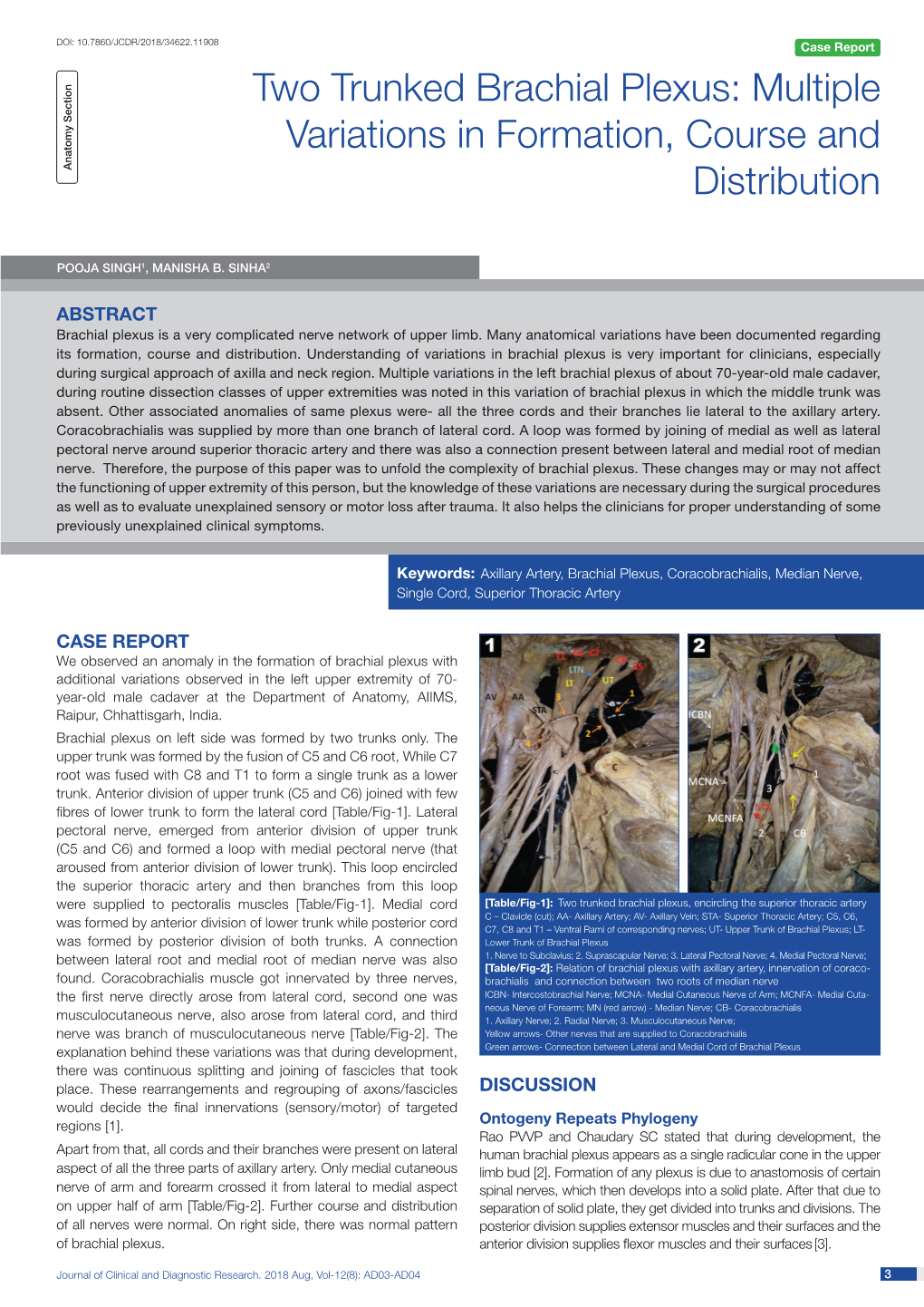 Two Trunked Brachial Plexus: Multiple Variations in Formation, Course and Anatomy Section Distribution