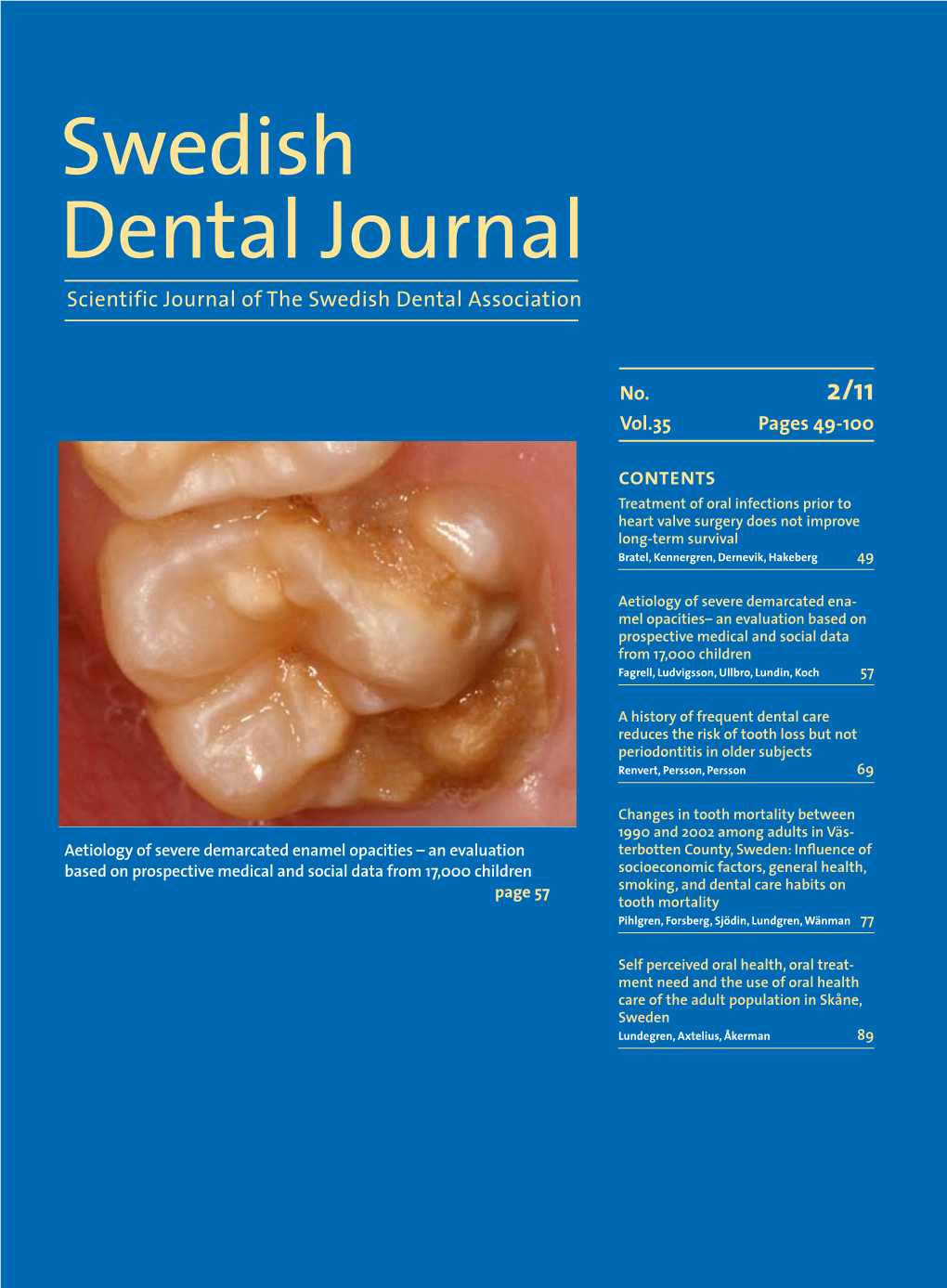 Swedish Dental Journal Scientific Journal of the Swedish Dental Association