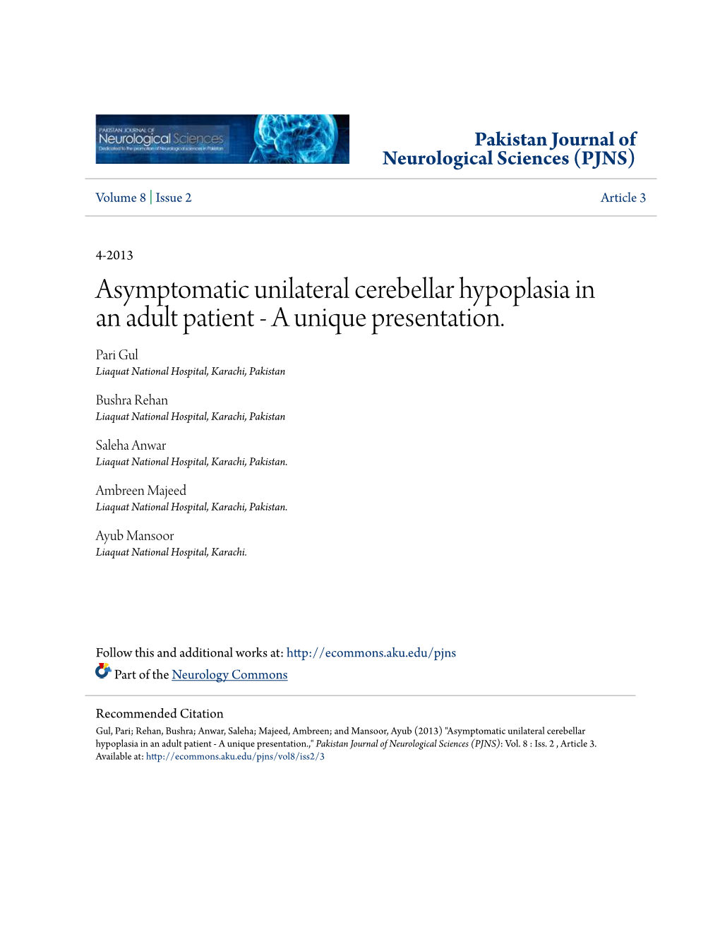 Asymptomatic Unilateral Cerebellar Hypoplasia in an Adult Patient - a Unique Presentation