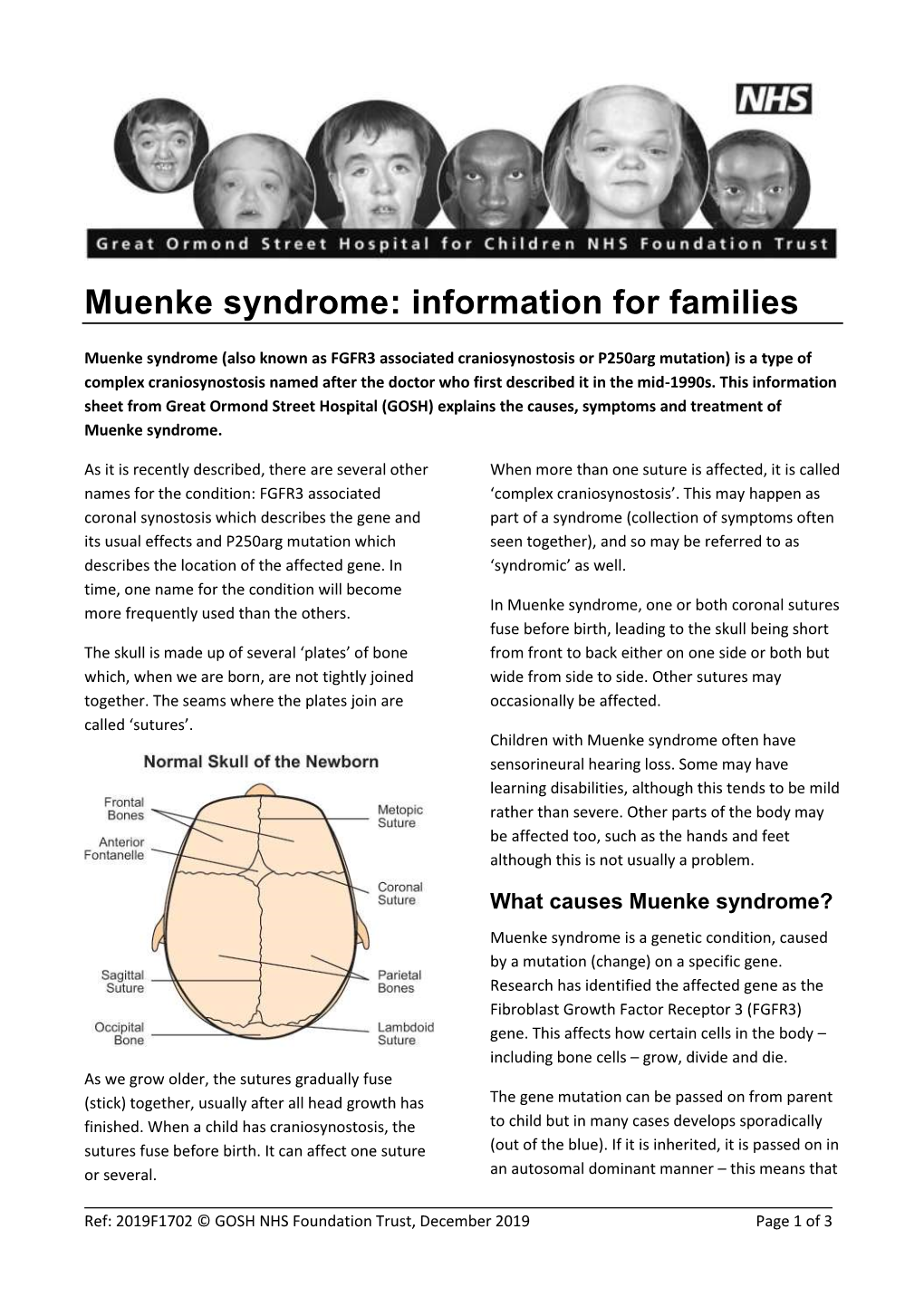 Muenke Syndrome: Information for Families