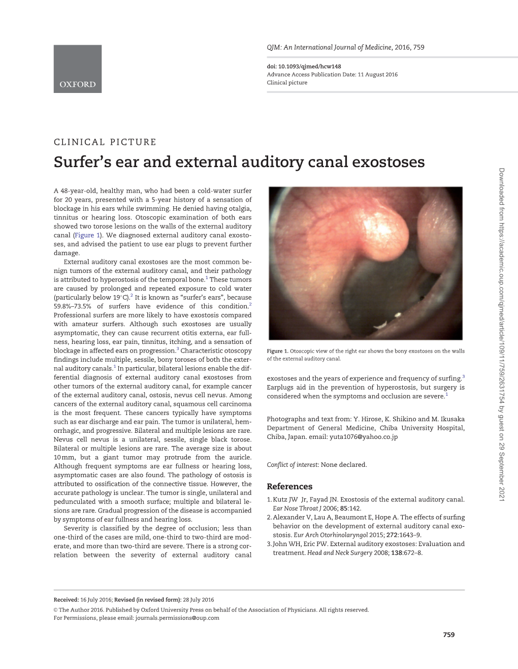 Surfer's Ear and External Auditory Canal Exostoses