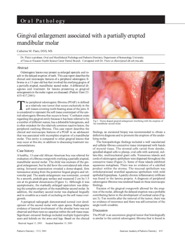 Gingival Enlargement Associated with a Partially Erupted Mandibular Molar