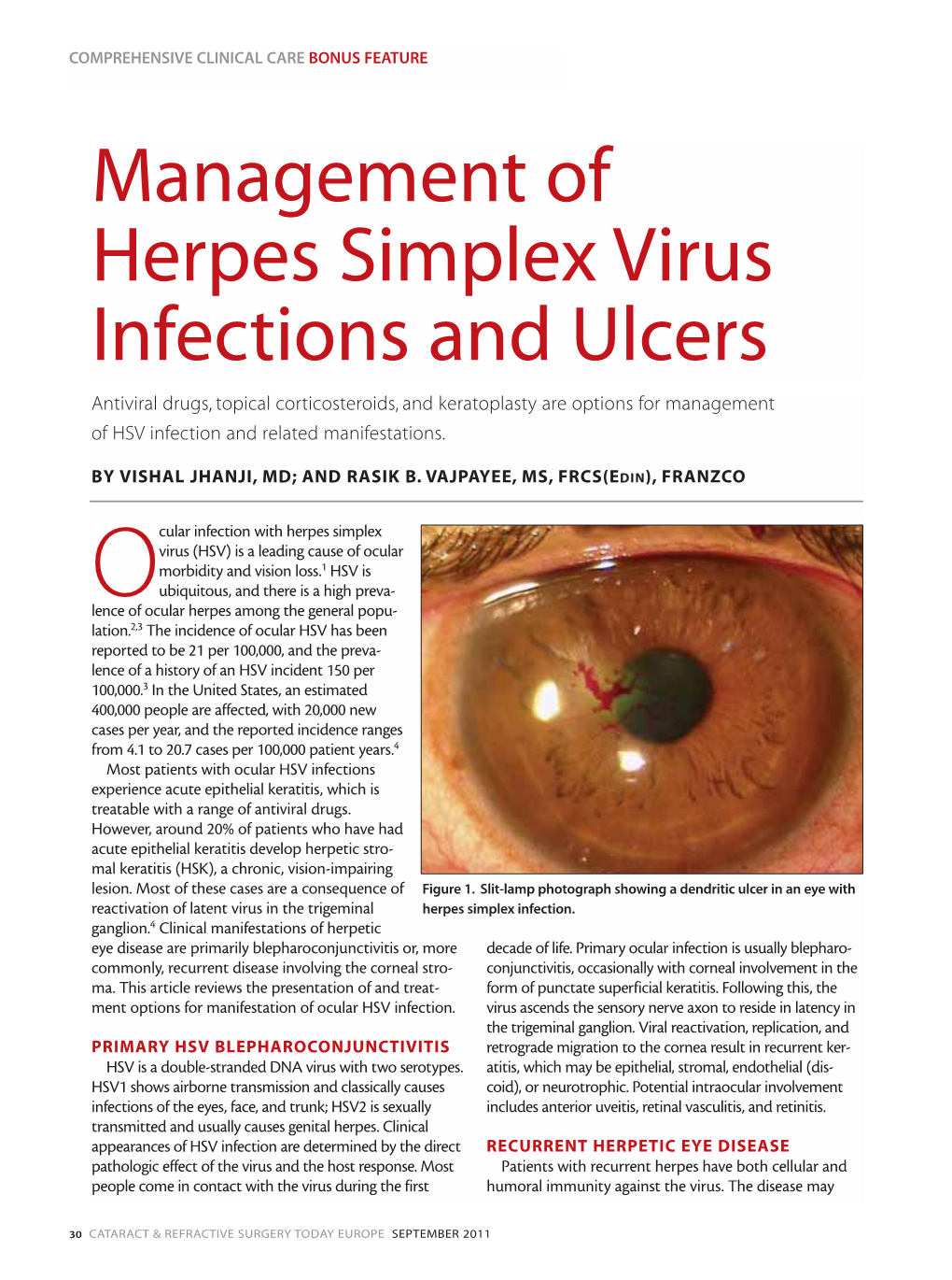 Management of Herpes Simplex Virus Infections and Ulcers