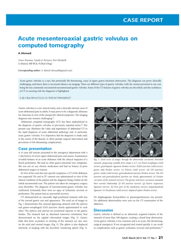 CASE REPORT Acute Mesenteroaxial Gastric Volvulus on Computed Tomography
