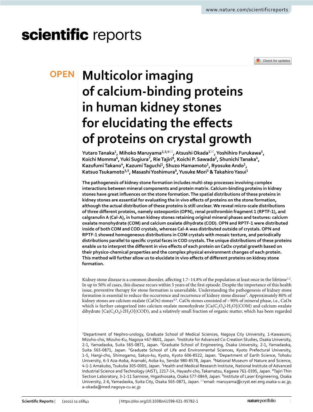 Multicolor Imaging of Calcium-Binding Proteins in Human Kidney Stones For