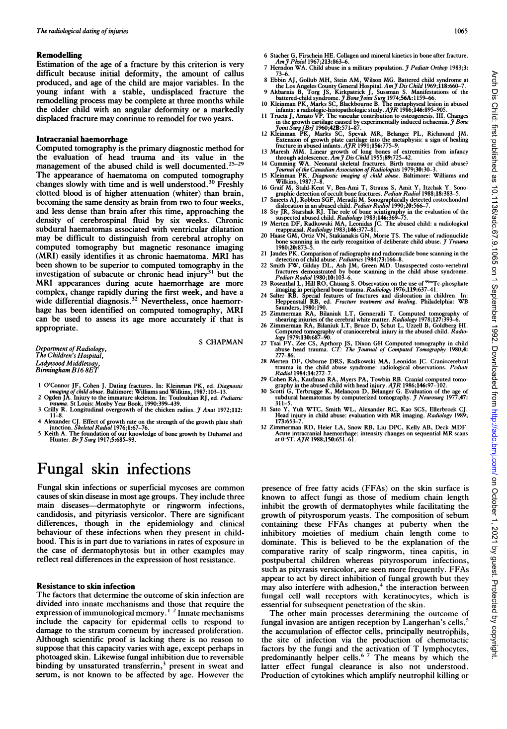 Fungal Skin Infections on October 1, 2021 by Guest