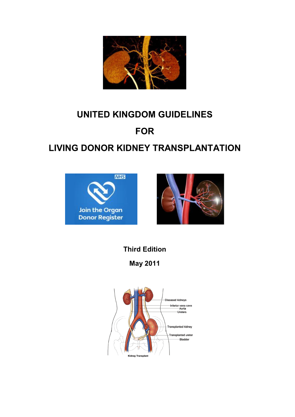 United Kingdom Guidelines for Living Donor Kidney Transplantation