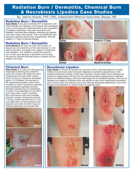 Radiation Burn / Dermatitis, Chemical Burn & Necrobiosis Lipodica Case Studies