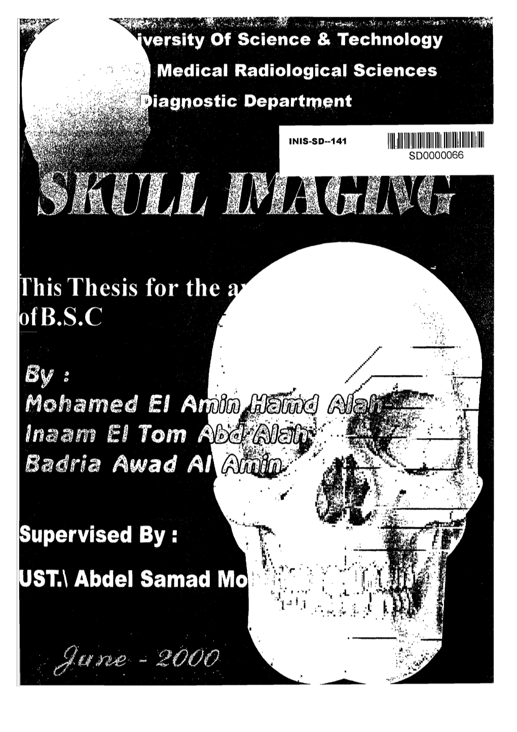 L.The External Jugular Vein