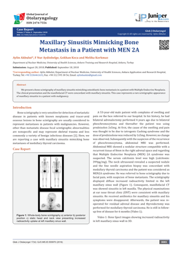 Maxillary Sinusitis Mimicking Bone Metastasis in a Patient with MEN 2A