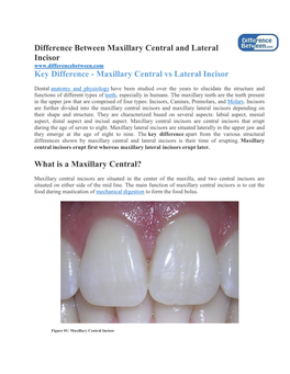Difference Between Maxillary Central and Lateral Incisor?