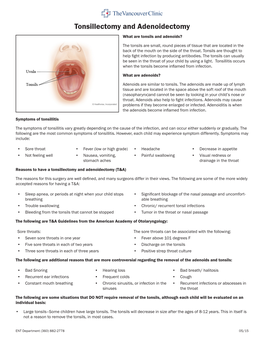 Tonsillectomy and Adenoidectomy What Are Tonsils and Adenoids?