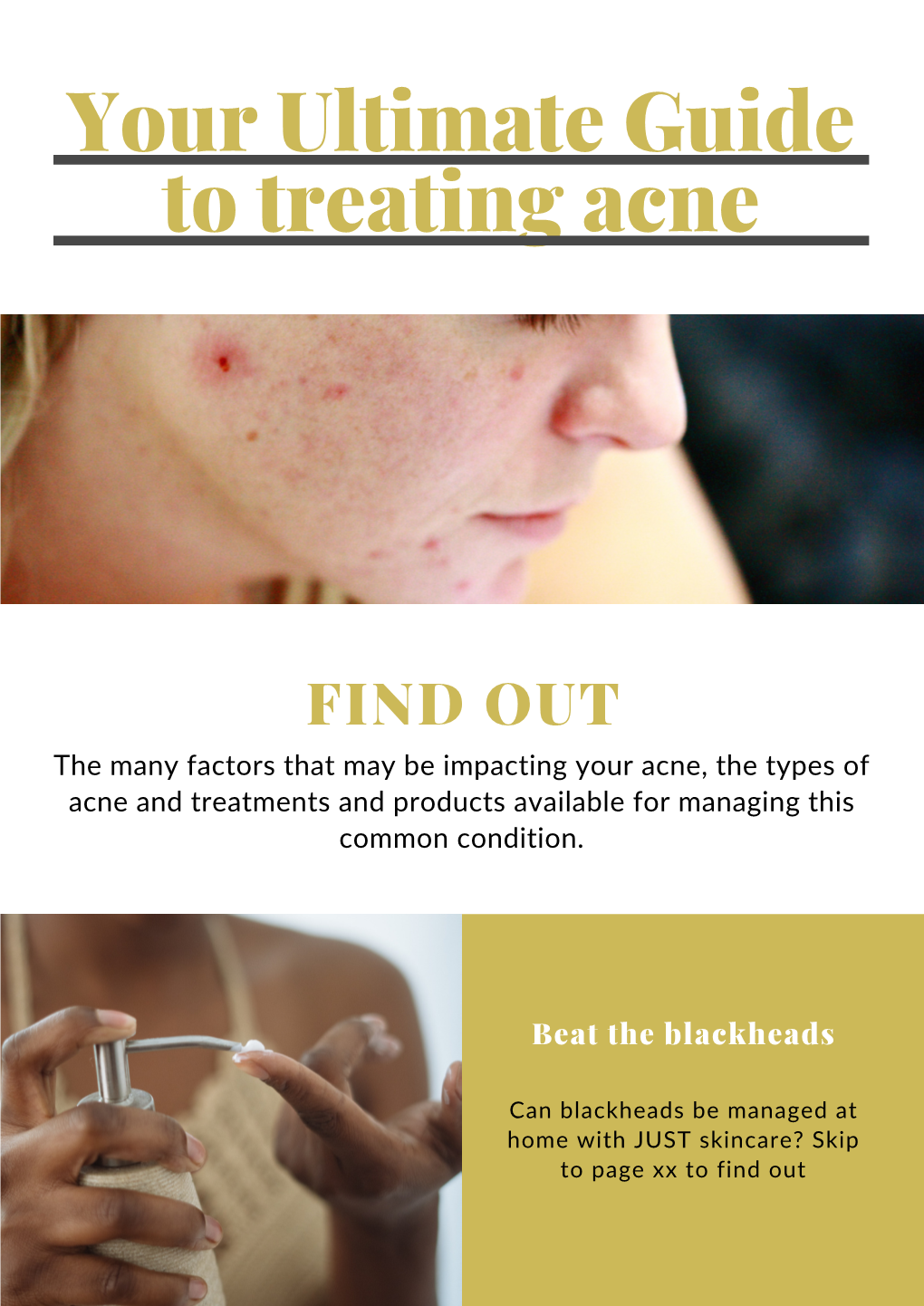 Download Your Ultimate Guide to Treat Acne