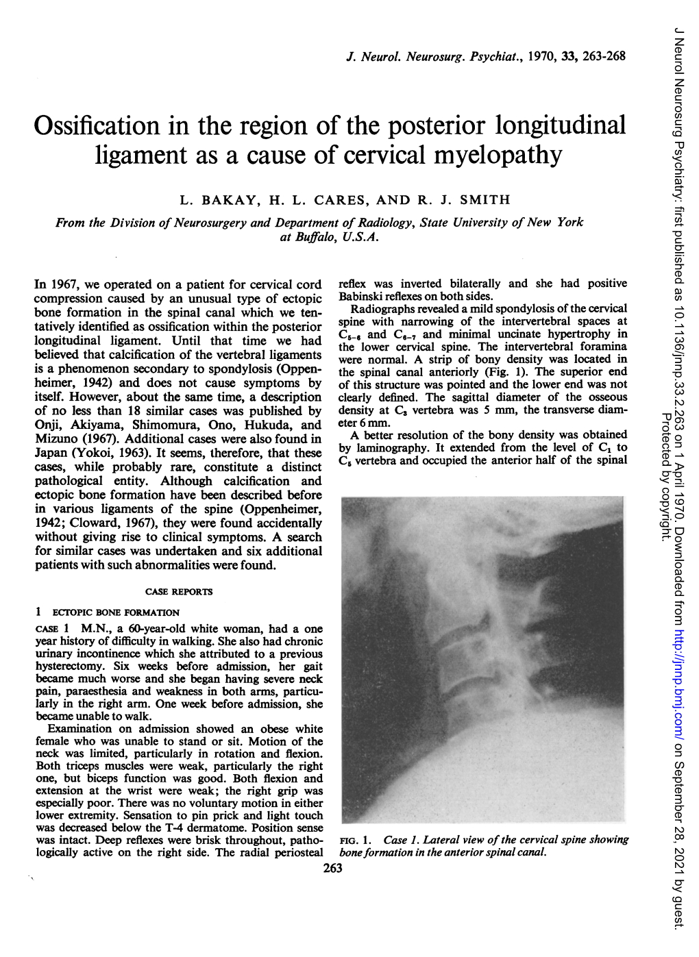 Ossification in the Region of the Posterior Longitudinal Ligament As a Cause of Cervical Myelopathy