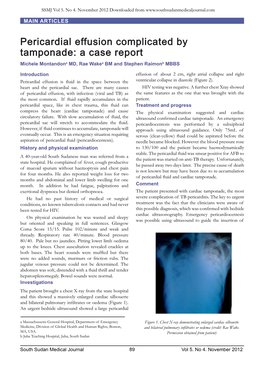Pericardial Effusion Complicated by Tamponade: a Case Report Michele Montandona MD, Rae Wakea BM and Stephen Raimonb MBBS