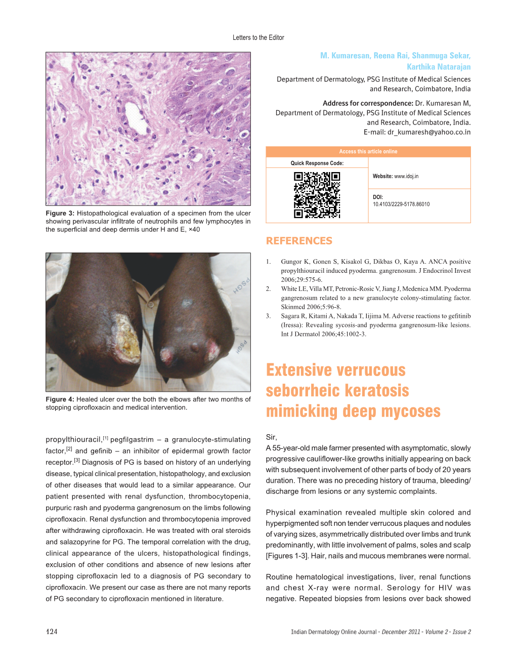 Extensive Verrucous Seborrheic Keratosis Mimicking Deep Mycoses