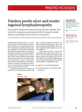 Painless Penile Ulcer and Tender Inguinal Lymphadenopathy
