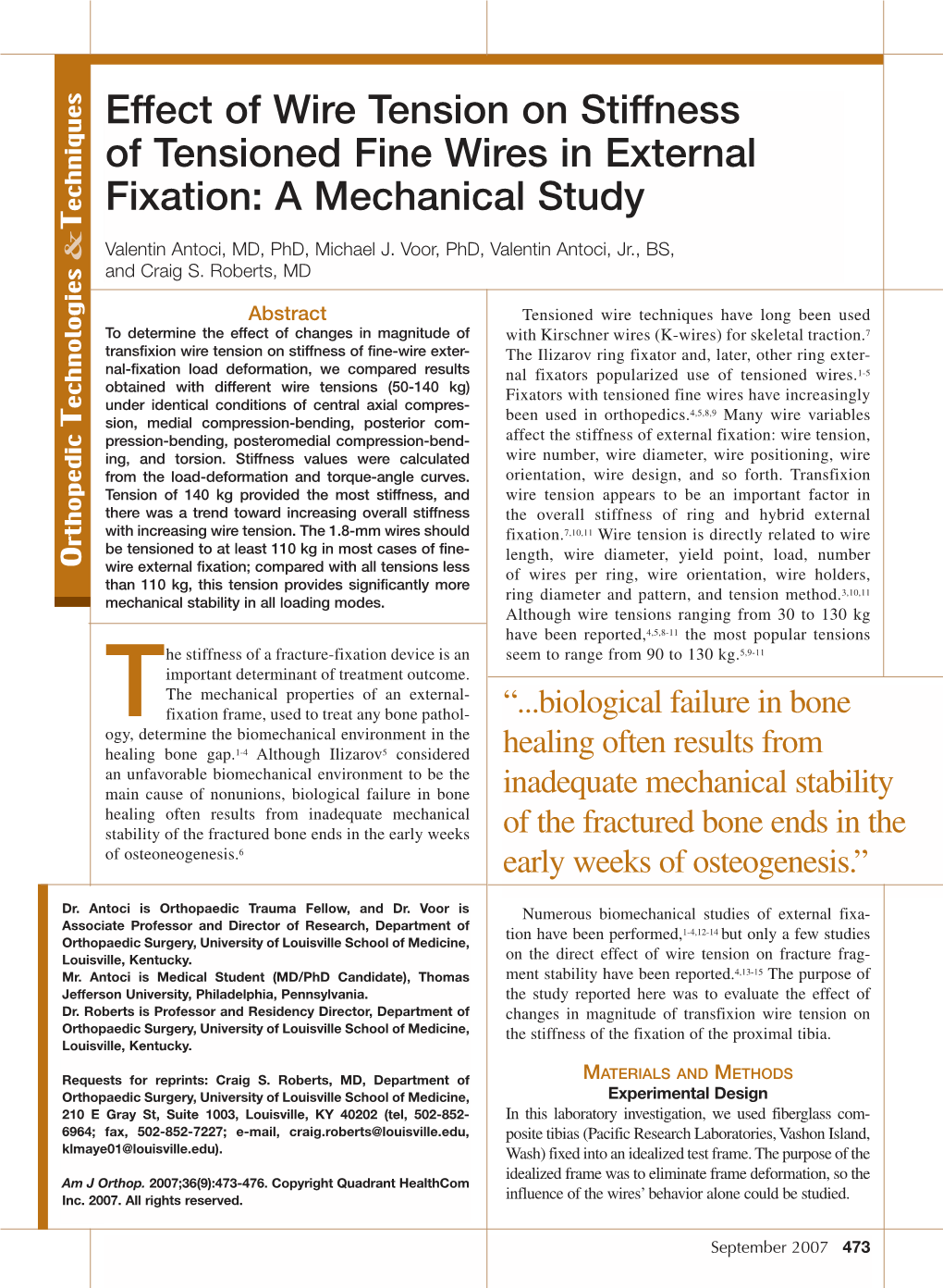 Effect of Wire Tension on Stiffness of Tensioned Fine Wires in External