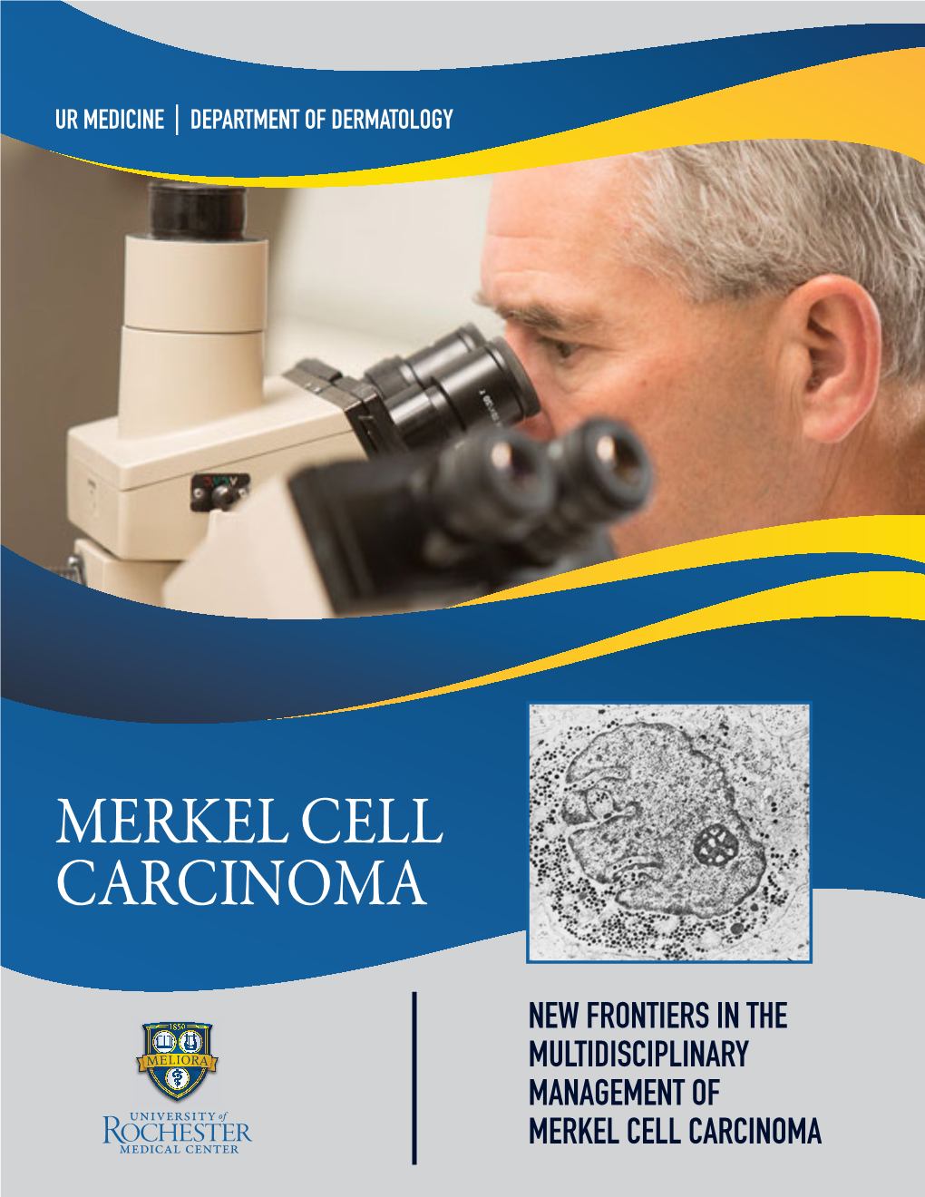 New Frontiers in the Multidisciplinary Management of Merkel Cell Carcinoma