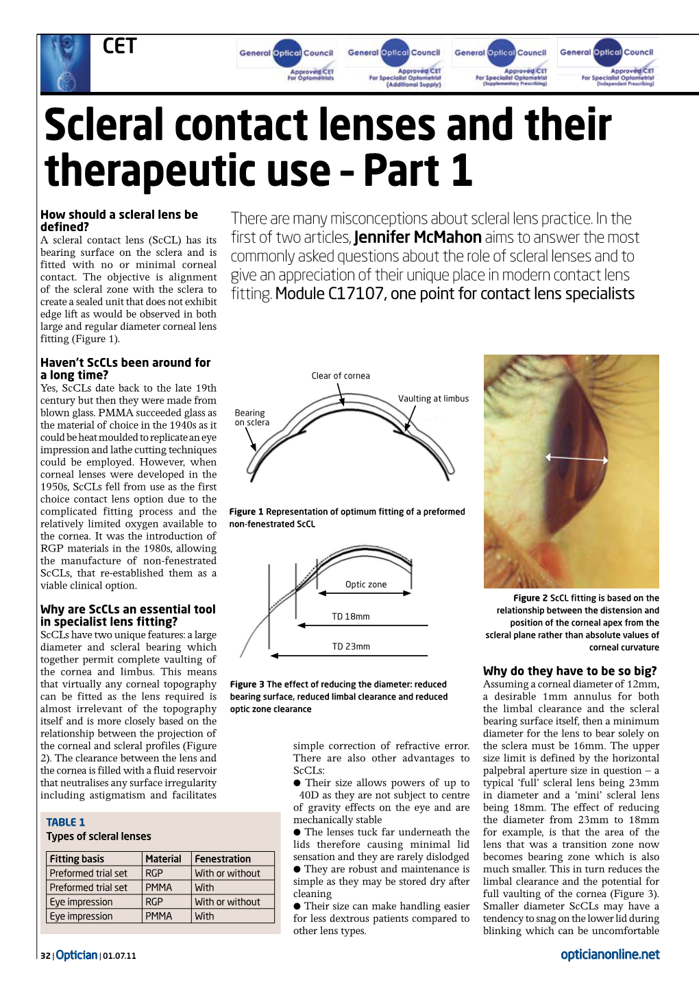 Scleral Contact Lenses and Their Therapeutic Use – Part 1 How Should a Scleral Lens Be There Are Many Misconceptions About Scleral Lens Practice