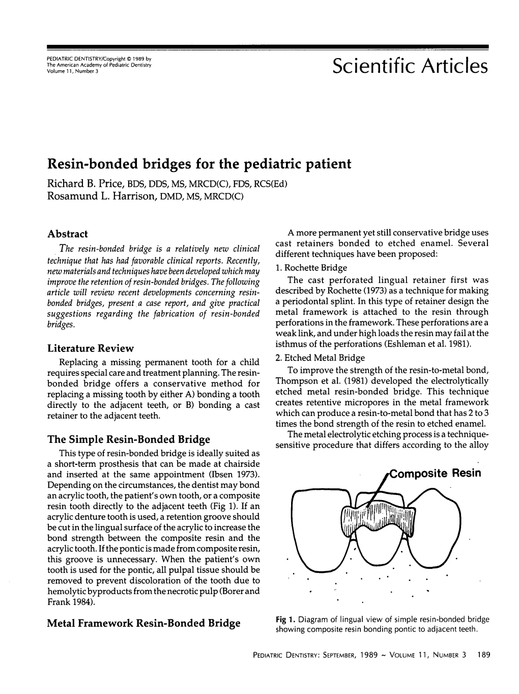 Resin-Bonded Bridges for the Pediatric Patient Richard B